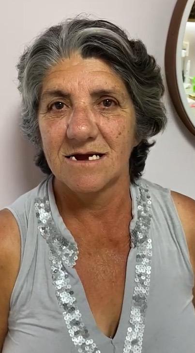 Mrs. Diomar — before Full Arch Protocol